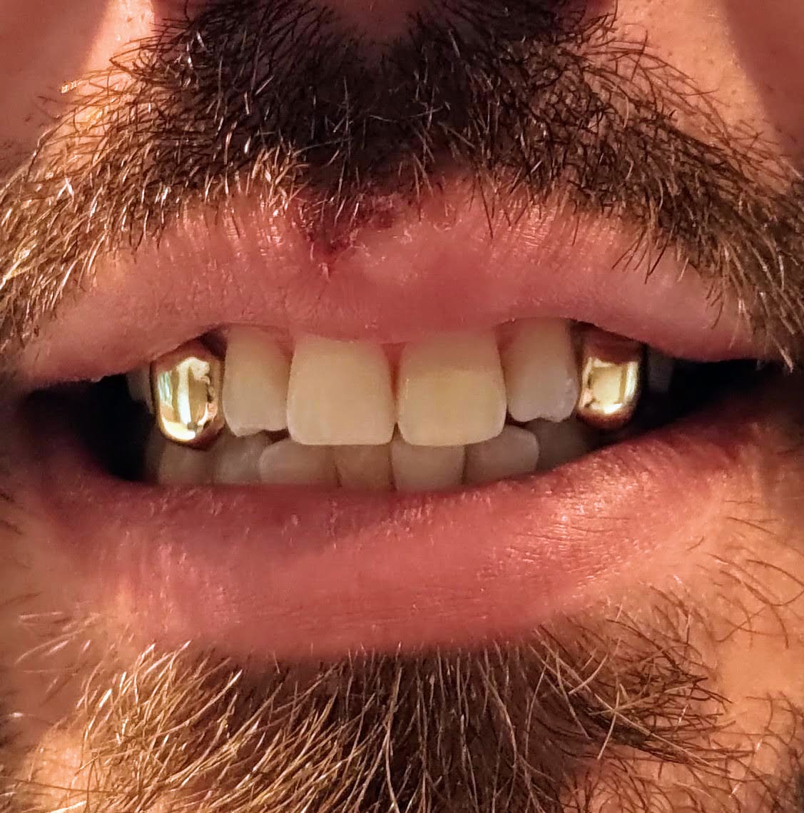 Gold grillz shop near on sale me